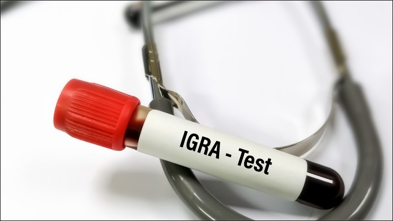 IGRA-Test dùng để tìm kháng thể lao trong máu 