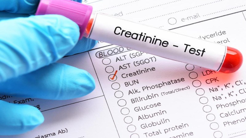 Xét nghiệm máu để đánh giá chức năng thận, tìm ra tình trạng thiếu máu, nhiễm trùng