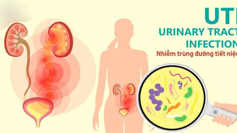 Điều trị kịp thời các bệnh nhiễm trùng bằng kháng sinh là cần thiết để ngăn ngừa tổn thương thận
