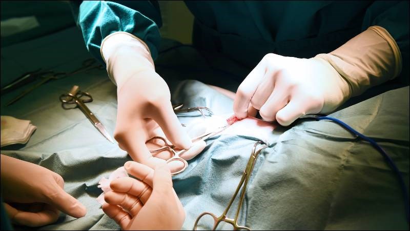Phẫu thuật ghép da giúp thay thế mô sẹo do bỏng sâu