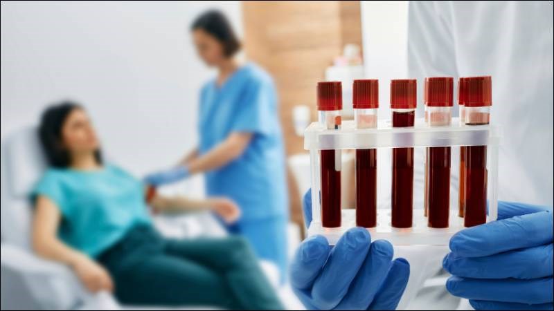 Một số xét nghiệm có thể được tiến hành với người bị bỏng da nặng