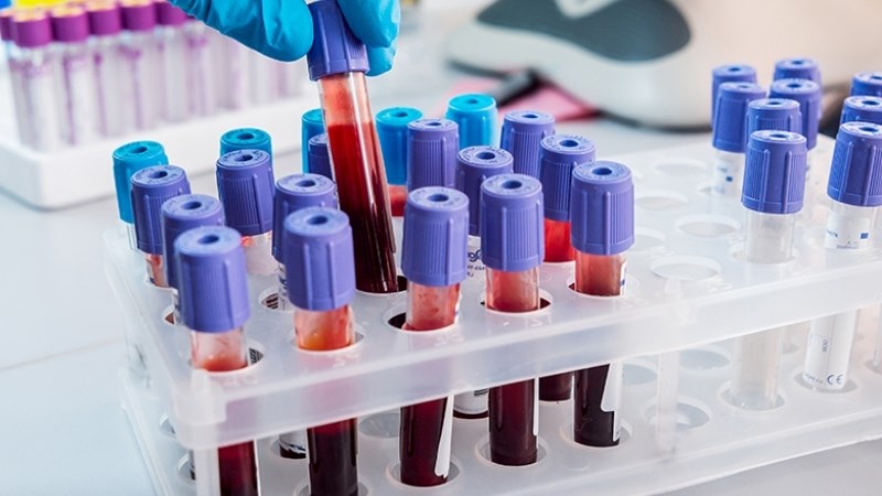 Xét nghiệm sinh hóa giúp kiểm tra hoạt độ của một số enzyme trong máu