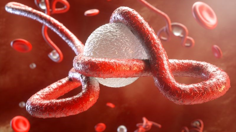 Mẹ bị Ebola khi mang thai có thể khiến trẻ mắc chân khoèo