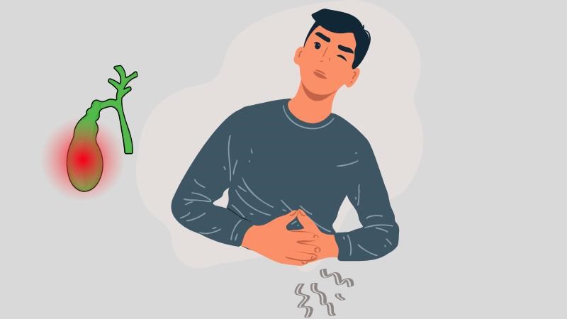 U cơ tuyến túi mật có thể gây biến chứng như viêm túi mật