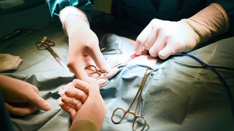 Phẫu thuật cắt bỏ túi mật nếu u cơ tuyến túi mật có triệu chứng