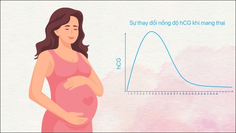 Sự tăng cao hCG ở giai đoạn đầu thai kỳ là nguyên nhân chính gây ốm nghén