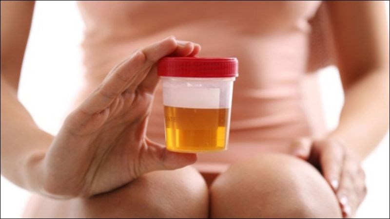 Chỉ tiểu được một ít nước tiểu sẫm màu có thể là dấu hiệu của mất nước