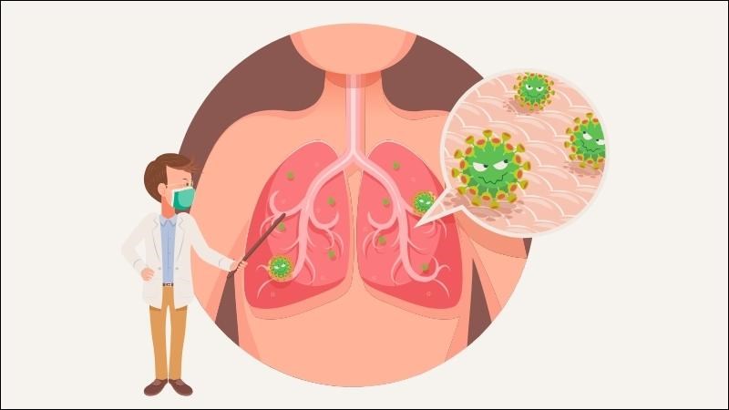 Viêm phổi có thể là nguyên nhân của ho về đêm