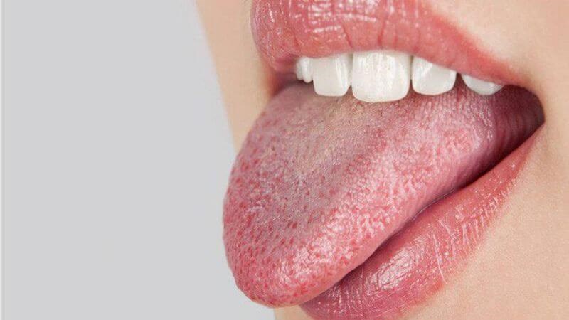 Khô miệng có thể dẫn tới tình trạng đắng miệng