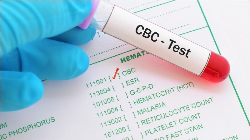 Công thức máu giúp xác định da xanh xao là do thiếu máu hay không