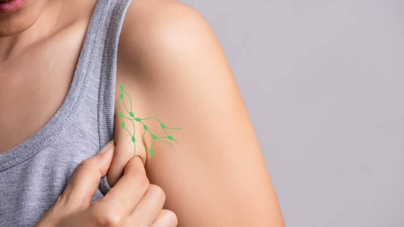 Nổi hạch ở nách là tình trạng hạch bạch huyết ở nách sưng to