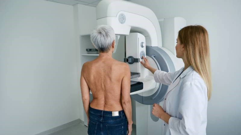 Chụp nhũ ảnh có thể được chỉ định khi bị nổi hạch nách