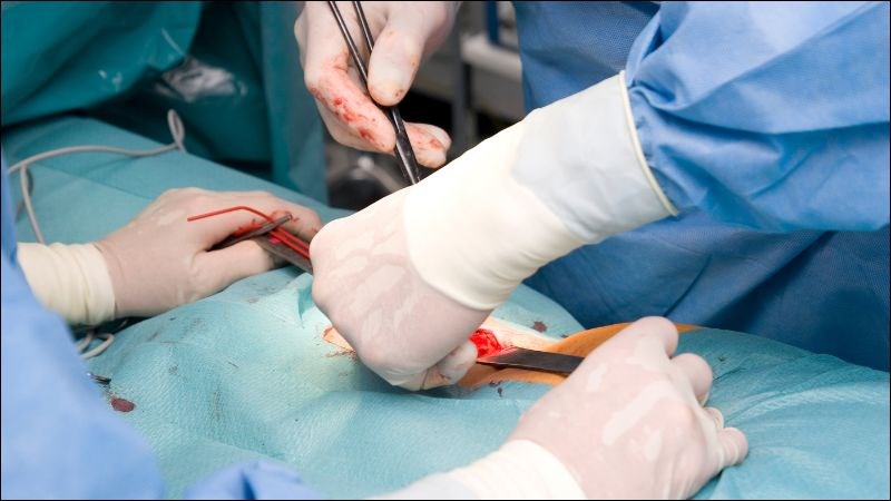 Đau cổ do nguyên nhân chèn ép dây thần kinh có thể cần được phẫu thuật Đau cổ do nguyên nhân chèn ép dây thần kinh có thể cần được phẫu thuật