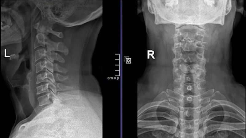 X-quang có thể giúp phát hiện các bất thường về xương X-quang có thể giúp phát hiện các bất thường về xương