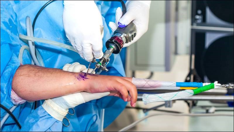 Nội soi khớp là tiêu chuẩn vàng để đánh giá đau cổ tay kéo dài