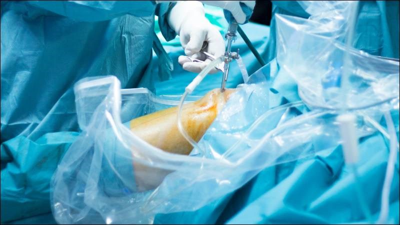 Phẫu thuật nội soi khớp thường được sử dụng để điều trị đau hông