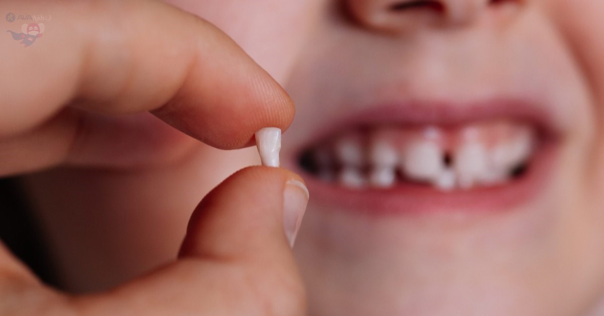  Cách nhổ răng sữa - Tìm hiểu về quy trình rụng và thay răng sữa