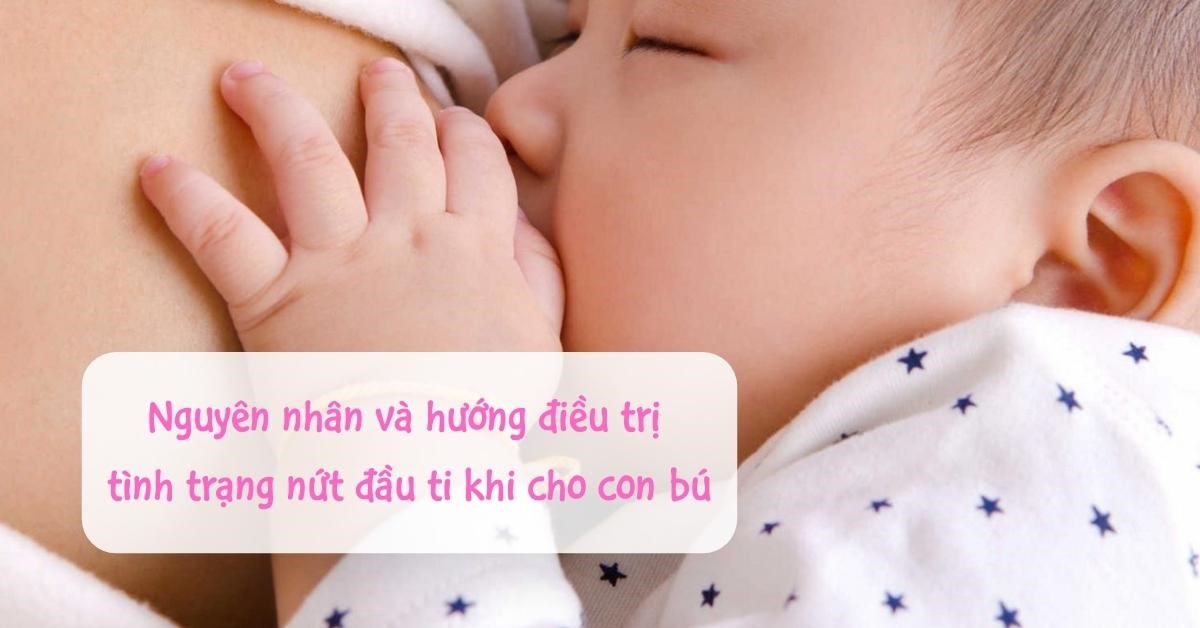 Nguyên nhân và cách điều trị nứt đầu ti không ảnh hưởng sữa mẹ