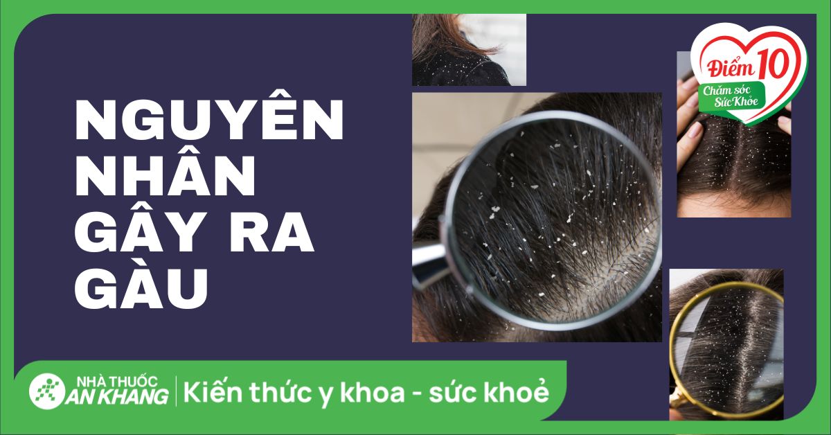 Nguyên nhân gây ra gàu là gì? Cách điều trị và phòng ngừa gàu tại nhà