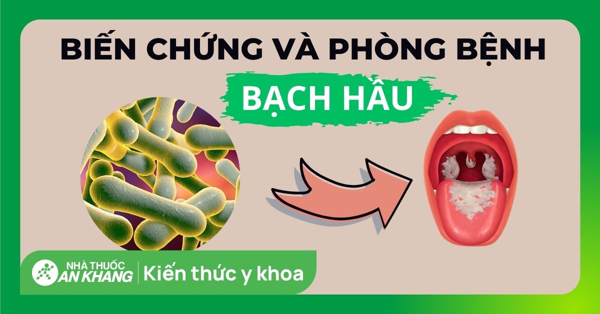 Cách phòng chống bệnh bạch hầu và biến chứng bạn nên biết