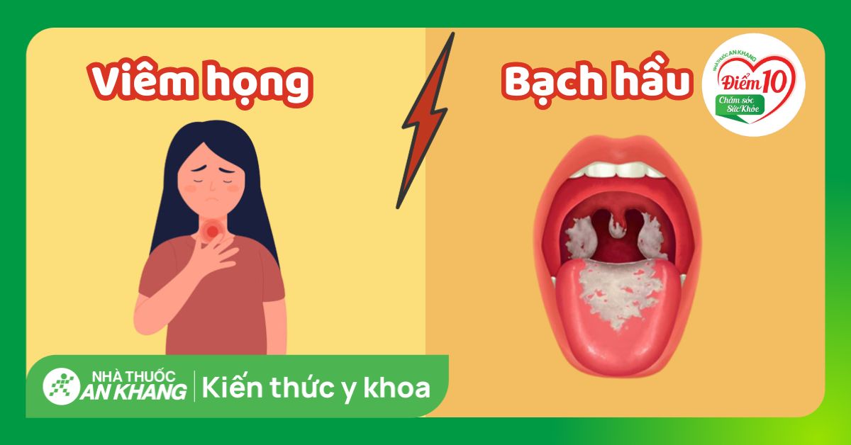 Phân biệt triệu chứng bạch hầu và viêm họng như thế nào?