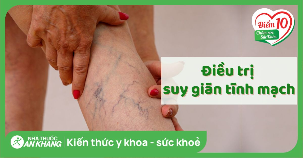 4 cách điều trị suy giãn tĩnh mạch chi dưới hiệu quả hiện nay