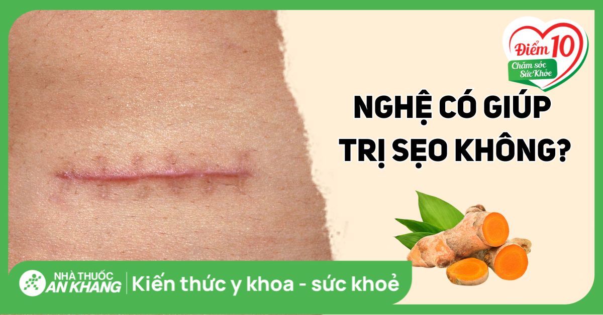 Sử dụng nghệ trị sẹo có thật sự hiệu quả không?