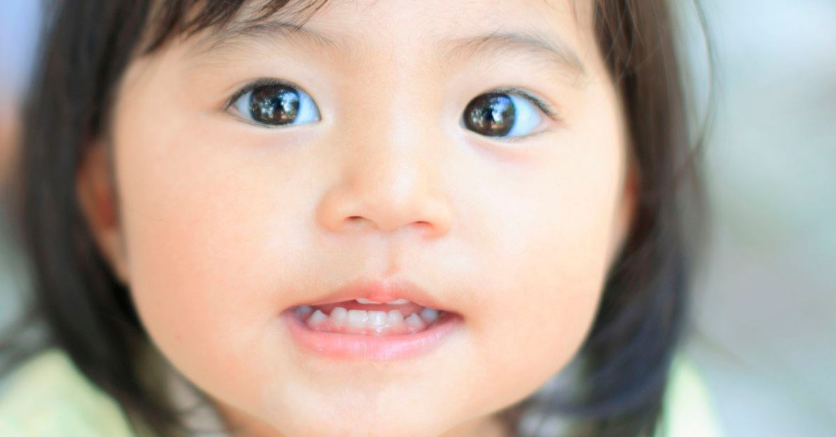 Mắt trẻ sơ sinh bị lác, cha mẹ nên làm gì?