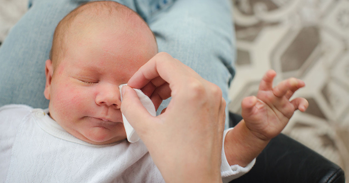 Các nguyên nhân gây bệnh đau mắt đỏ ở trẻ sơ sinh và cách phòng tránh hiệu quả