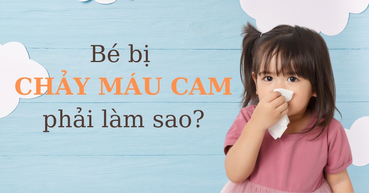 Bé bị chảy máu cam phải làm sao? Cách xử trí an toàn tại nhà