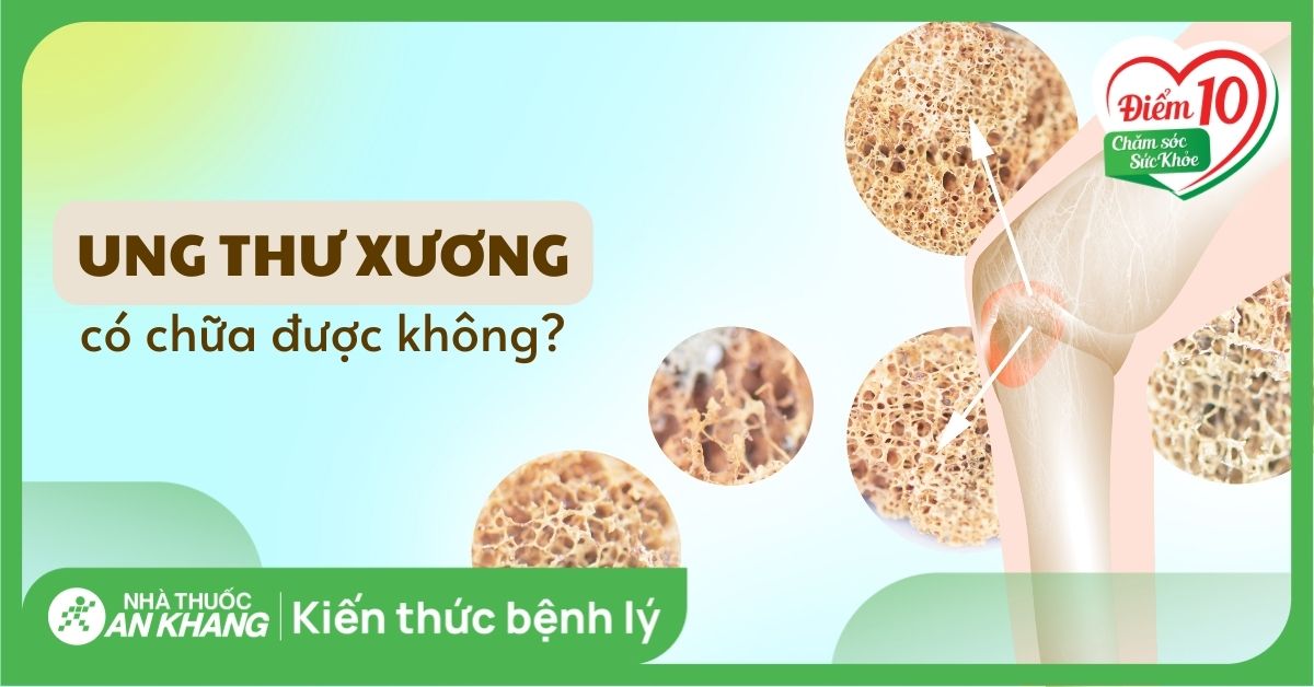 Ung thư xương có chữa được không? Phương pháp điều trị ung thư xương