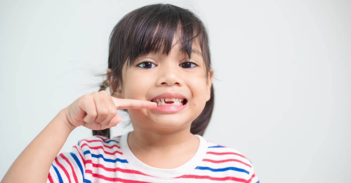 Răng sữa lung lay bao lâu thì nhổ? Cần lưu ý gì khi trẻ thay răng?