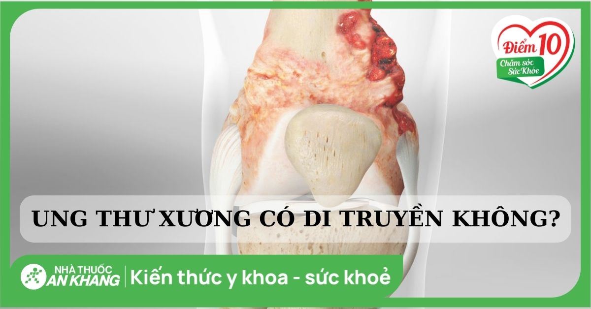 Bệnh ung thư xương có di truyền không? 10 nguyên nhân gây bệnh