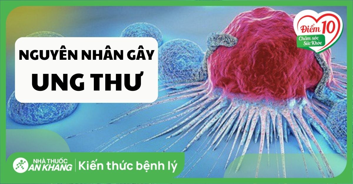 15 nguyên nhân gây ung thư mà bạn có thể nhận biết để phòng ngừa