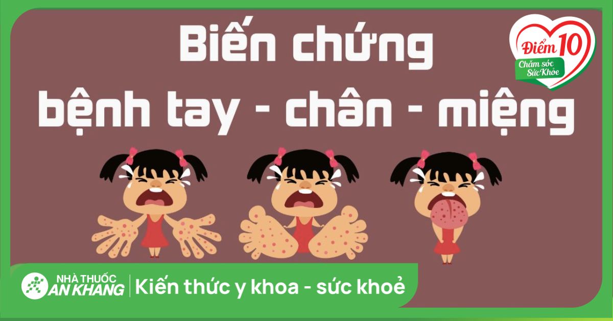 Các biến chứng tay chân miệng cực kỳ nguy hiểm bạn nên biết