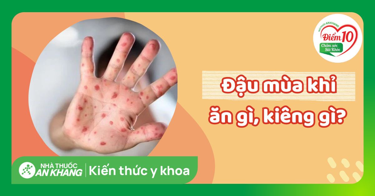 Bị đậu mùa khỉ nên ăn gì, kiêng gì? 7 thực phẩm giúp nhanh hồi phục