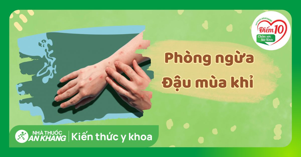 Các cách phòng ngừa bệnh đậu mùa khỉ chuẩn theo hướng dẫn của Bộ Y tế