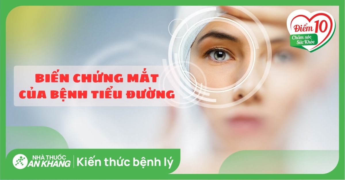 7 biến chứng của bệnh tiểu đường lên mắt và các biện pháp phòng ngừa