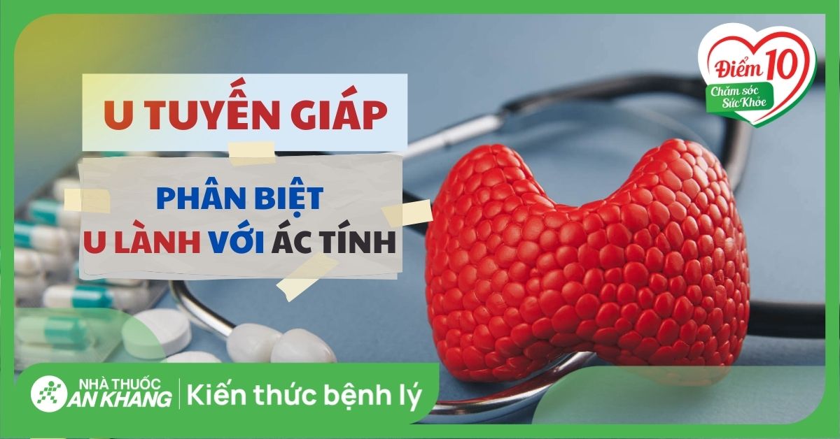 Các dấu hiệu u tuyến giáp, phân biệt u tuyến giáp ác tính và lành tính