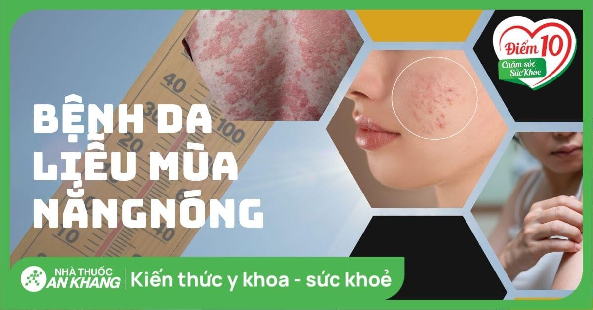 16 bệnh da liễu thường gặp trong mùa nắng nóng bạn nên biết