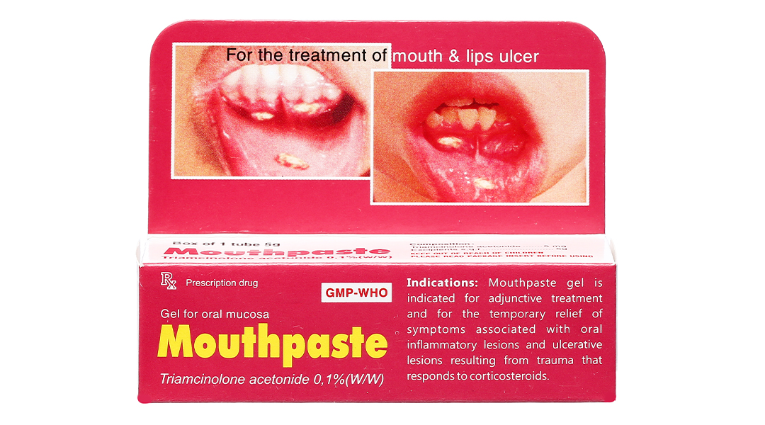 What are the therapeutic properties of Mouthpaste and its main active ingredient, triamcinolone acetonide?