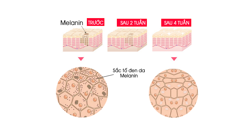 Melanin trong da sẽ ảnh hưởng theo thời gian việc sản xuất nhiều Melanin khiến da bị sẫm màu. Khi sử dụng sữa dưỡng trắng da OHUI thì Melanin trong da sẽ sản sinh chậm lại, từ đó vết nám sẽ mờ hơn, trả lại làn da tươi trẻ trắng sáng hơn
