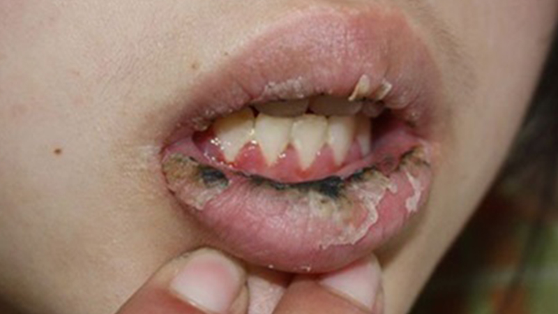 Tác hại kinh hoàng khi dùng son môi giả