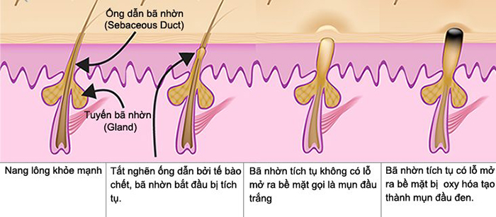 Công dụng của nước tẩy trang - 1