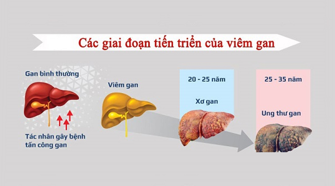 Gan - một nhà máy sinh học lọc bỏ các chất có hại