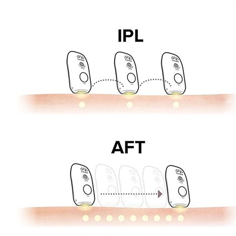 Máy triệt lông cá nhân Homedics IPL-HH390