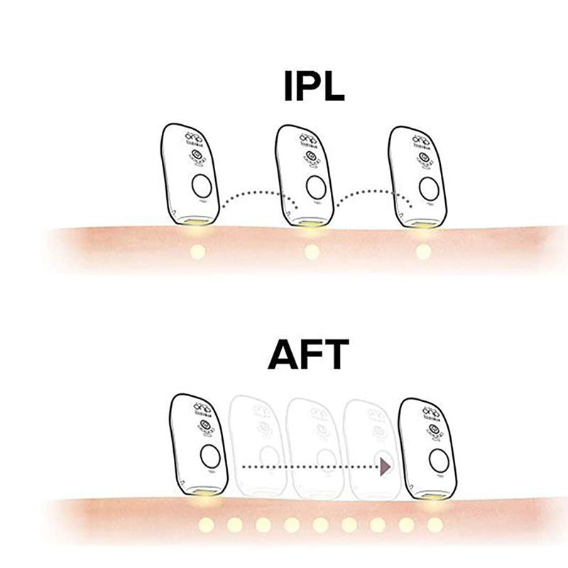 Máy triệt lông cá nhân Homedics IPL-HH390