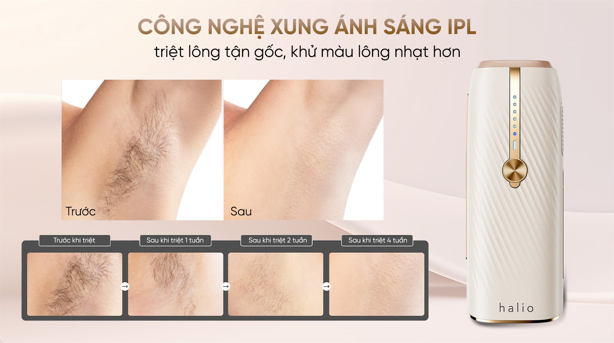 Máy triệt lông lạnh Sapphire Halio Infinity Glow Advanced IPL