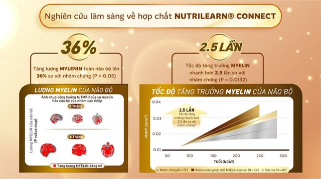 Nutrilearn connect trong sữa bột Nestlé S-26 Ultima số 3 750g (2 - 6 tuổi) được nghiên cứu lâm sàng