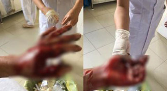 Pin điện thoại bị nổ 4